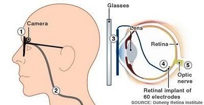 Bionic Eye Idea